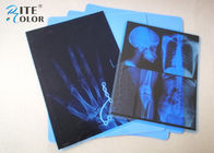Χαμηλή ομίχλης μπλε ταινία απεικόνισης της PET Inkjet ιατρική 8 X 10 ίντσα για τον εκτυπωτή Epson