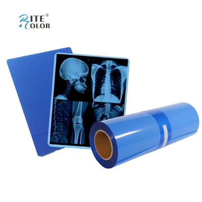 IMATEC Blue PET Inkjet Medical CR X-Ray Radiography Film Για εκτυπωτές Canon