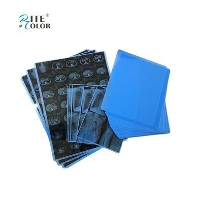 Εκτύπωση με μελάνι PET Blue Medical Film για ακτίνες Χ Α4 8x10 14x17 φύλλα