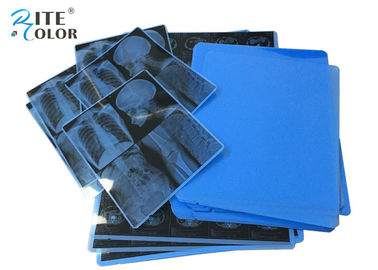 11 X 14 ιατρική ξηρά ταινία ακτίνας X ταινιών A4 PET Inkjet απεικόνισης λέιζερ ίντσας για MRT χρωμίου CT